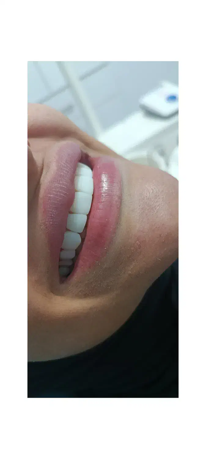 کامپوزیت|پزشکی|خرم‌آباد, |دیوار