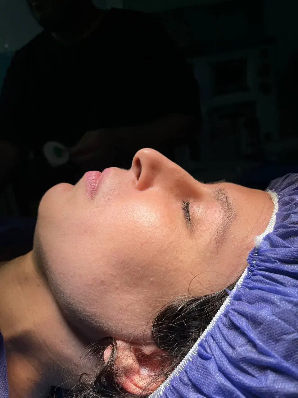 جراحی بینی باتخفیف ویژه جشنواره|خدمات آرایشگری و زیبایی|ساری, |دیوار