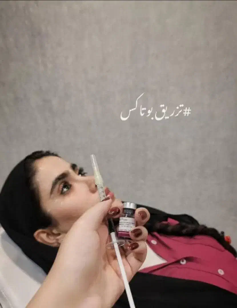 تزریقات ژل و بوتاکس|خدمات آرایشگری و زیبایی|دوگنبدان, |دیوار