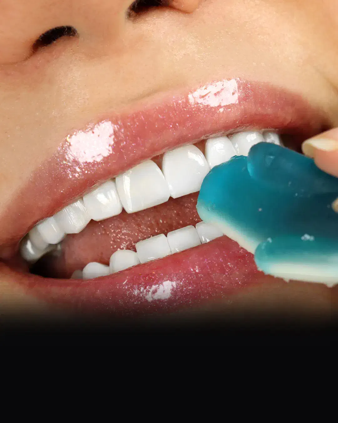 عصبکشی/کامپوزیت/کشیدن دندان|خدمات آرایشگری و زیبایی|ساری, |دیوار