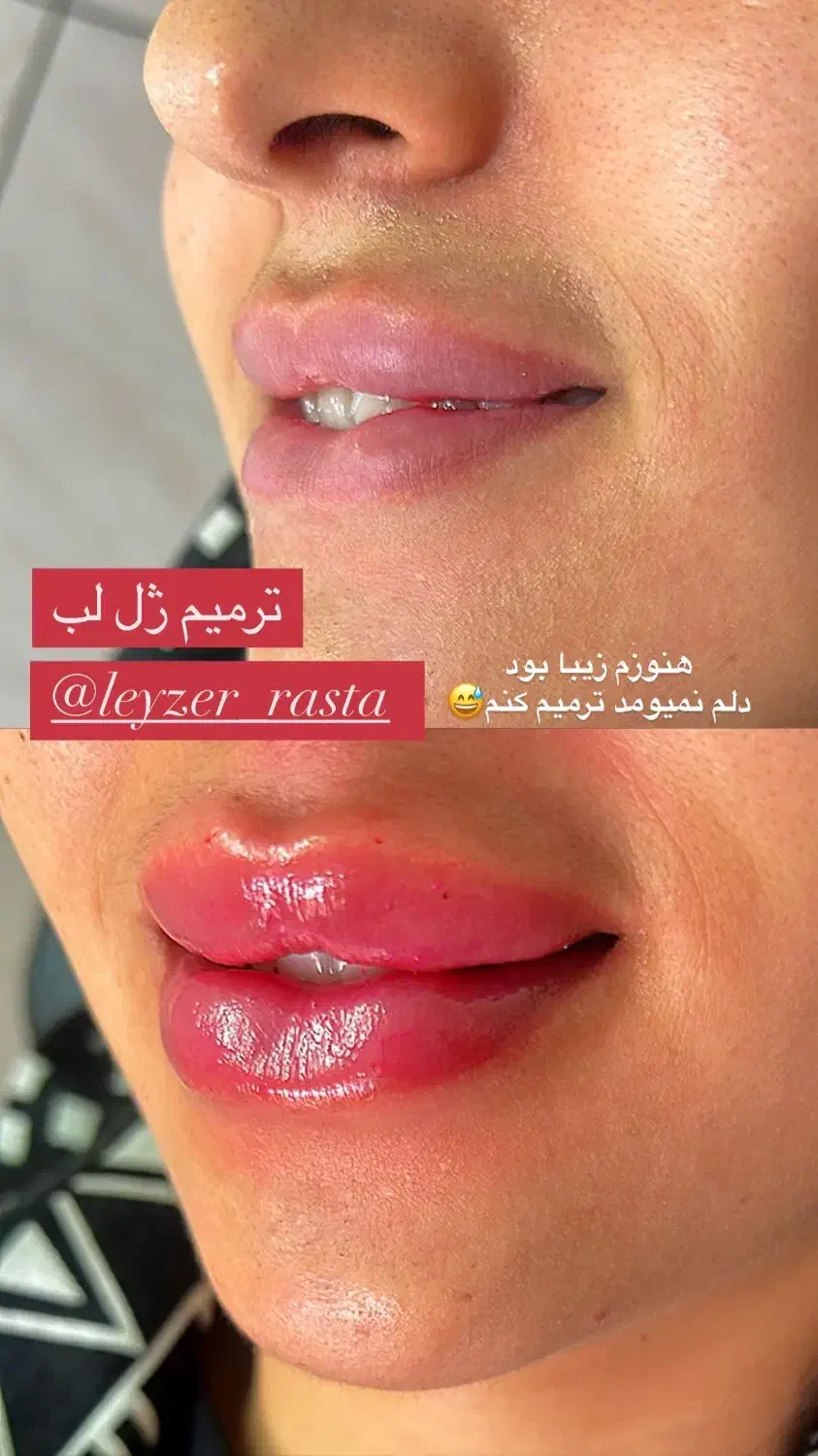 لیزر و زیبایی خمینی شهر|خدمات آرایشگری و زیبایی|خمینی‌شهر, |دیوار