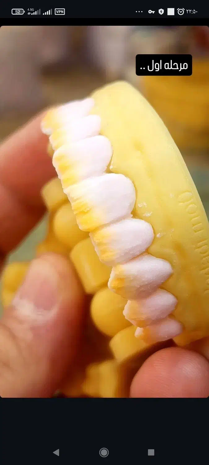 پودرگذار پرسلن نیازمندیم|استخدام درمانی، زیبایی، بهداشتی|نسیم‌شهر, |دیوار