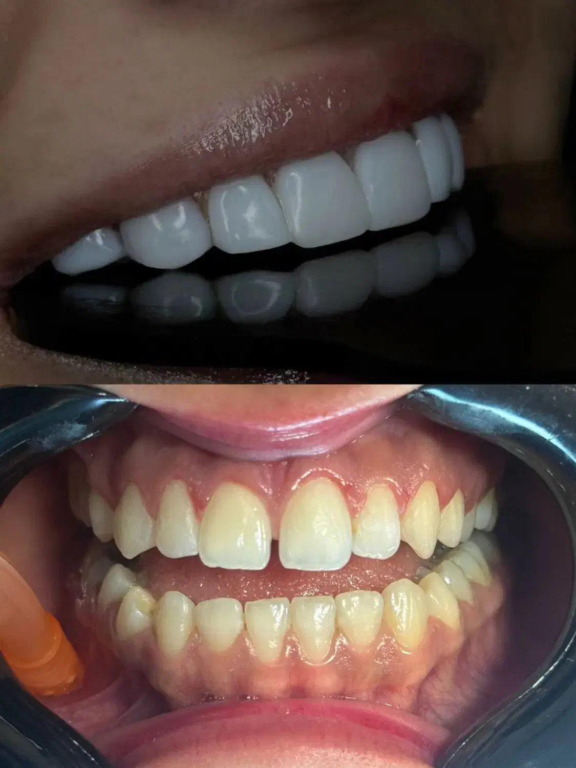 جشنواره پائیز کامپوزیت لمینت|خدمات آرایشگری و زیبایی|تهران, مدائن|دیوار