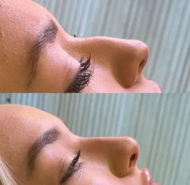 آموزش نخ لیفت فیلر ژل بوتاکس لیزر مو فشیال طب سنتی|خدمات آموزشی|اصفهان, شهریار|دیوار