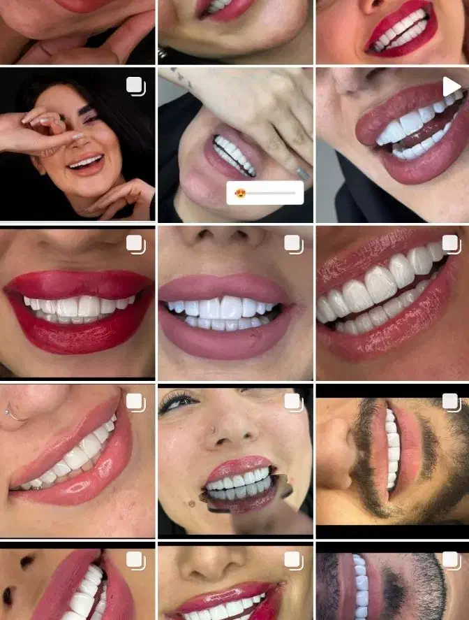 کامپوزیت زیبایی|خدمات آرایشگری و زیبایی|شاهیوند, |دیوار