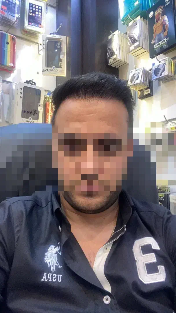 کاشت ابرو وکاشت مو فقط 15 میلیون|خدمات آرایشگری و زیبایی|تربتحیدریه, مسجد جامع|دیوار