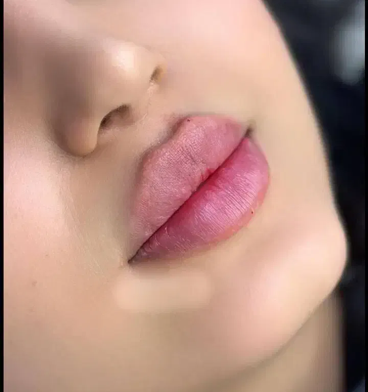 جشنواره ژل بوتاکس فقط سیسی ۴۰۰ و تاتو صورت و بدن|خدمات آرایشگری و زیبایی|فردیس, شهرک شهید حسینی|دیوار