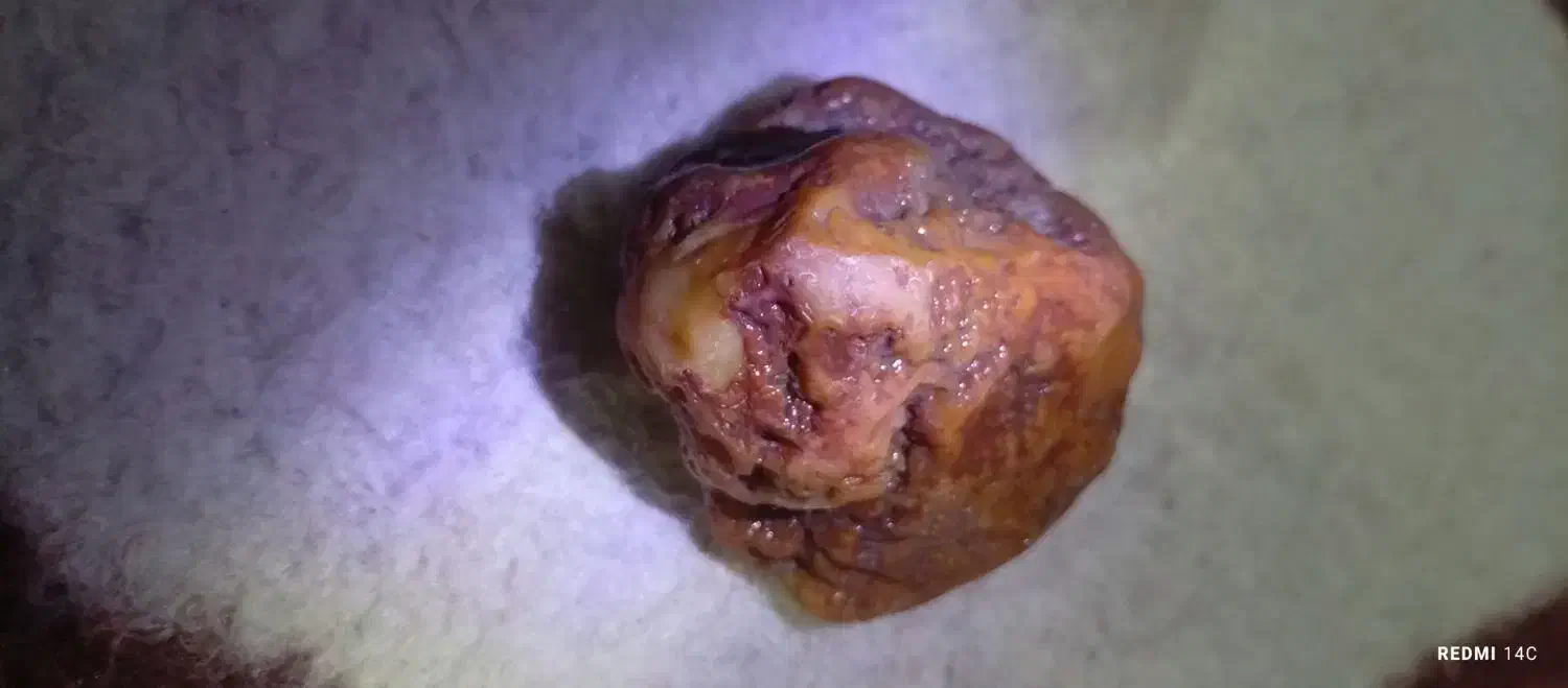 سنگ عقیق|کلکسیون اشیاء عتیقه|خوی, |دیوار