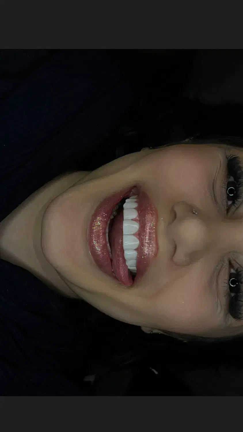 کامپوزیت زیبایی|خدمات آرایشگری و زیبایی|فومن, |دیوار