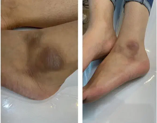 رفع تیرگی صورت وبدن فیشال تخصصی|خدمات آرایشگری و زیبایی|تهران, سلسبیل جنوبی|دیوار