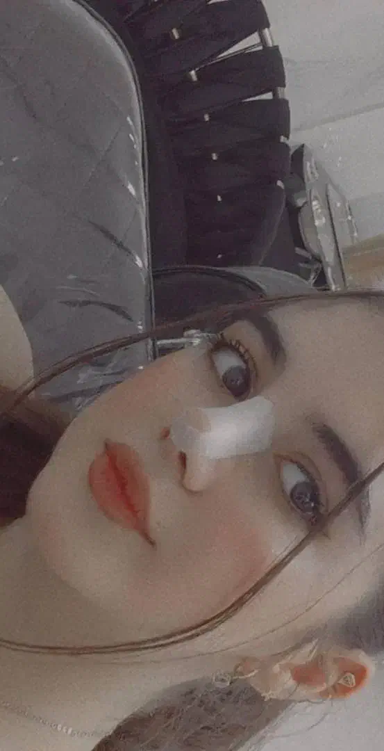 عمل جراحی بینی فقط ۲۶ملیون در تهران کرج|خدمات آرایشگری و زیبایی|کاشان, فاز ۲ ناجی آباد|دیوار