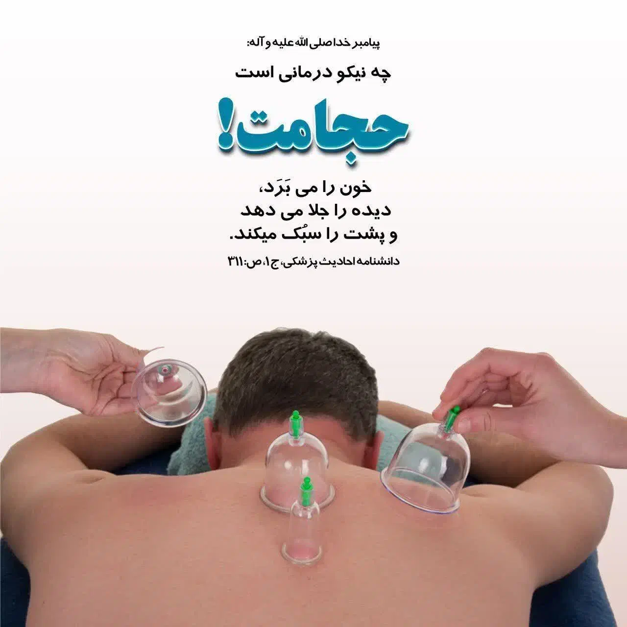 بادکش وحجامت|خدمات آرایشگری و زیبایی|قائن, |دیوار