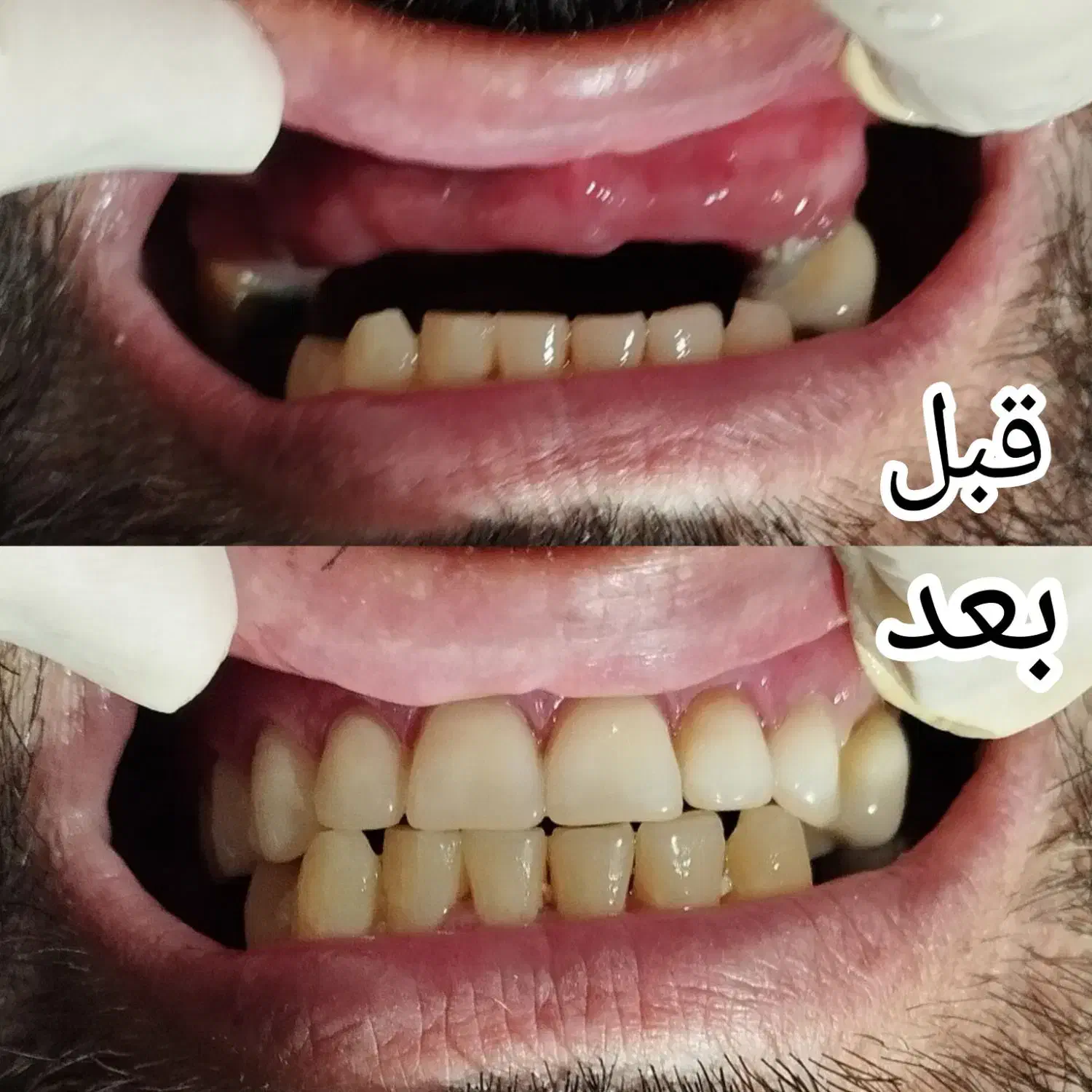 دندانسازی ، دندان مصنوعی|خدمات آرایشگری و زیبایی|مشهد, راه آهن|دیوار