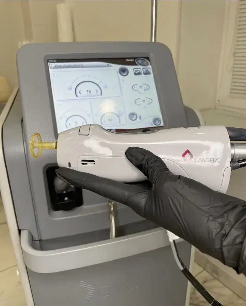 لیزر موهای زائد الکساندرایت کلاریتی و کندلا 2024|خدمات آرایشگری و زیبایی|اصفهان, سعادتآباد|دیوار