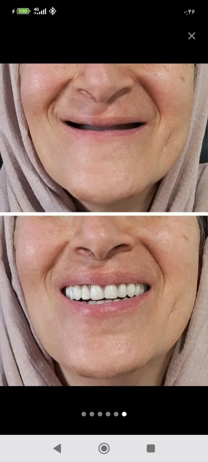 دندانسازی متحرک و ثابت|آرایشی، بهداشتی، درمانی|فردیس, شهرک ناز|دیوار