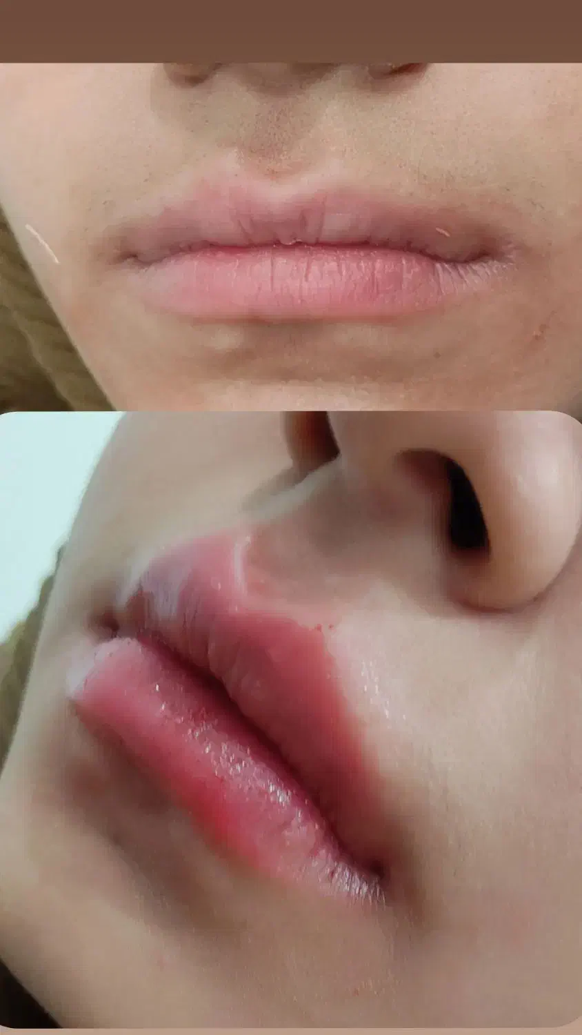 لیزر وزیبایی طلا|خدمات آرایشگری و زیبایی|سنندج, |دیوار