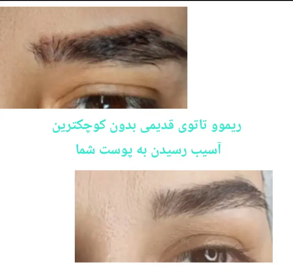 تخفیف پائیزه ریموو ،شیدینگ لب به مدت محدود|خدمات آرایشگری و زیبایی|محمدیه-قزوین, |دیوار