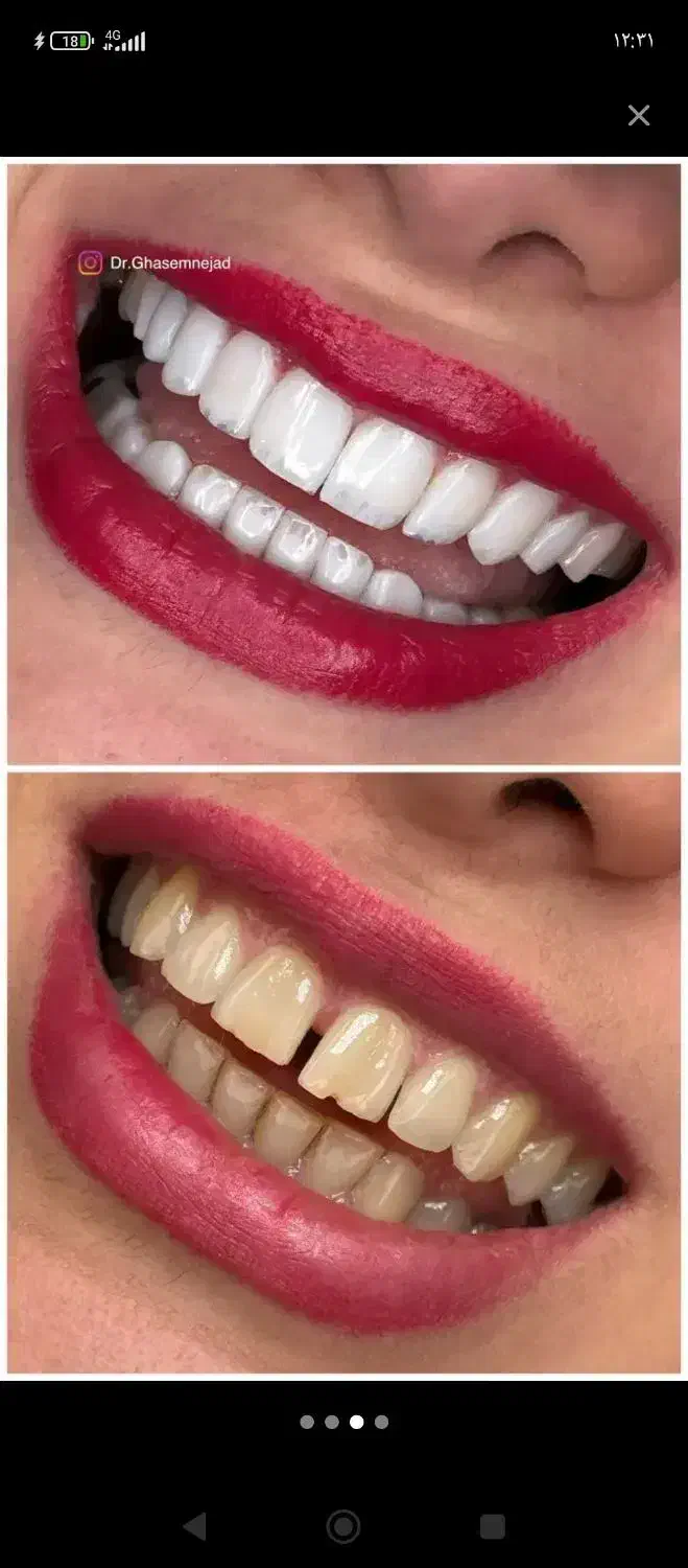 کوهدشت|خدمات آرایشگری و زیبایی|کوهدشت, |دیوار