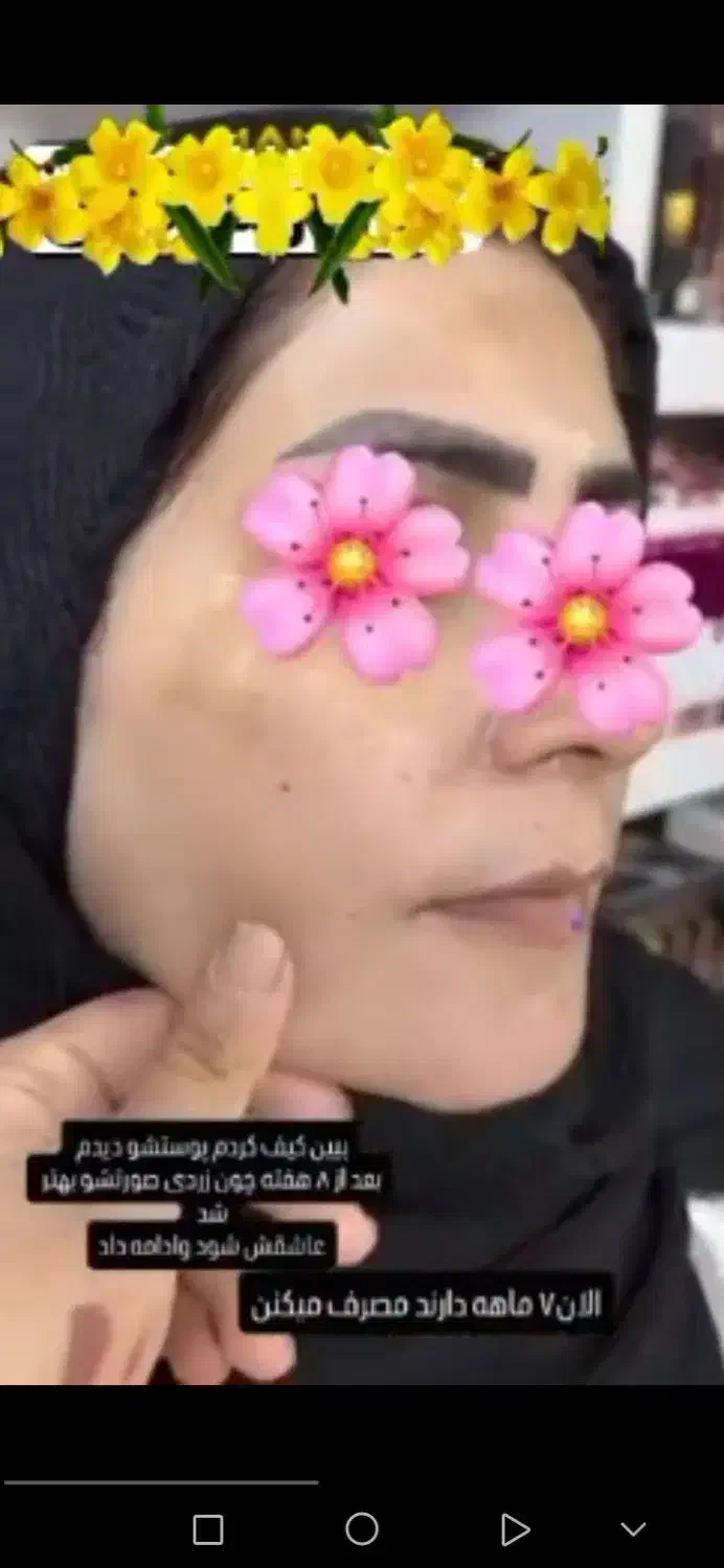 کرم ژل رویال بهترین ضدلک|آرایشی، بهداشتی، درمانی|قم, امامزاده ابراهیم|دیوار