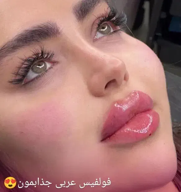 تزریق ژل و بوتاکس|خدمات آرایشگری و زیبایی|اردبیل, |دیوار