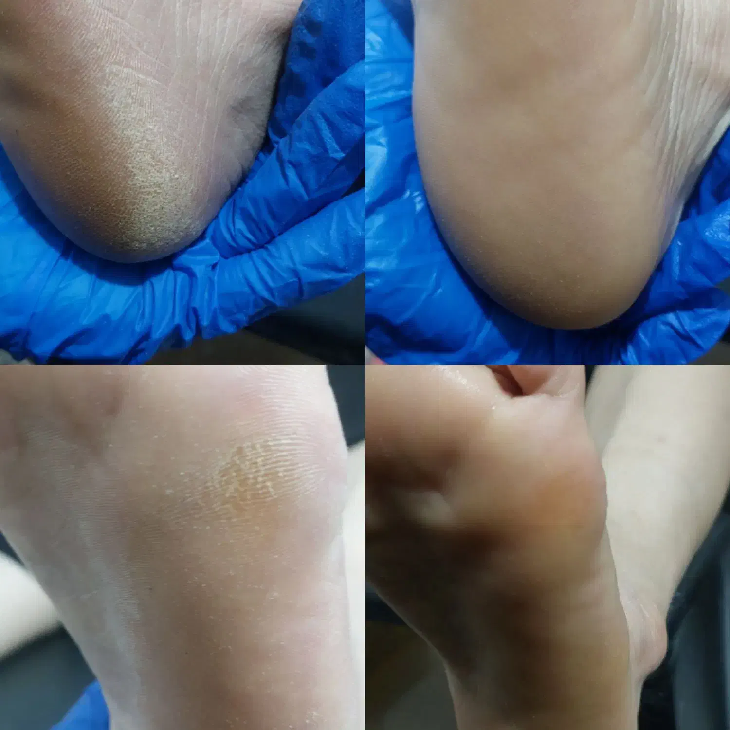 آموزش تخصصی ناخن و پدیکور|خدمات آموزشی|آستارا, |دیوار