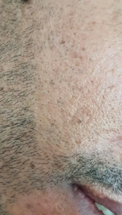 جشنواره پاییزی لیزر.لاغری.کرایو.ژل.آراف|خدمات زیبایی و سلامت|تهران, افسریه شمالی|دیوار