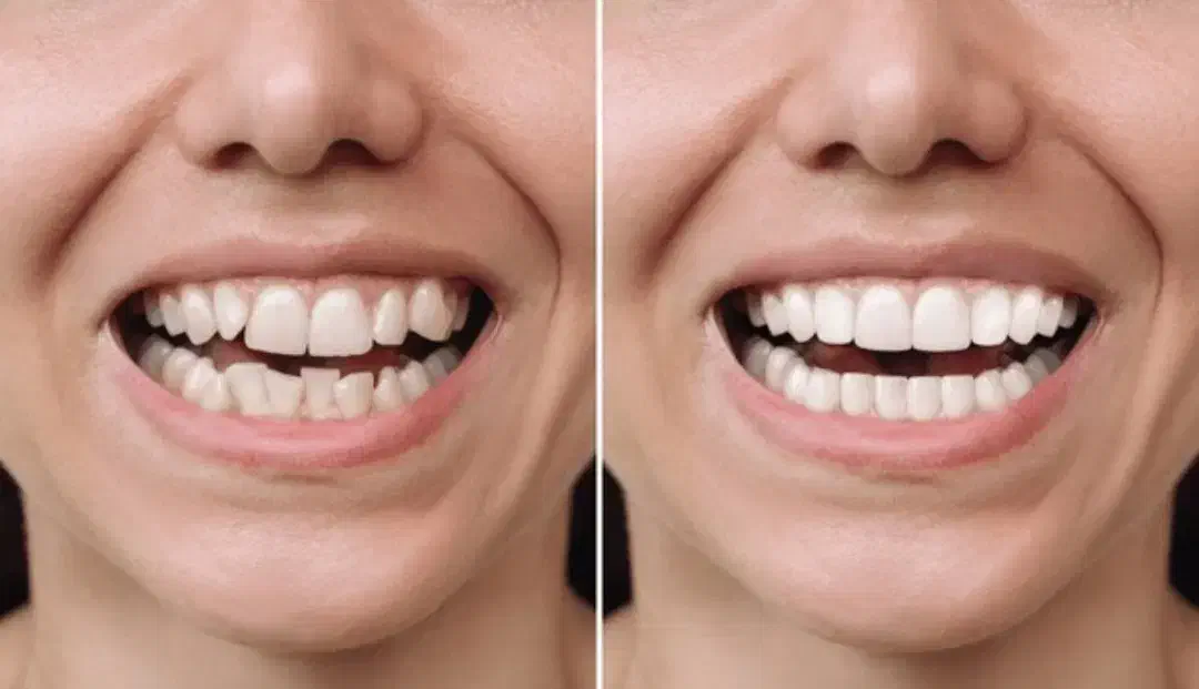ارتودنسی تخصصی با اقساط بلندمدت بدون سود|خدمات آرایشگری و زیبایی|گرگان, |دیوار