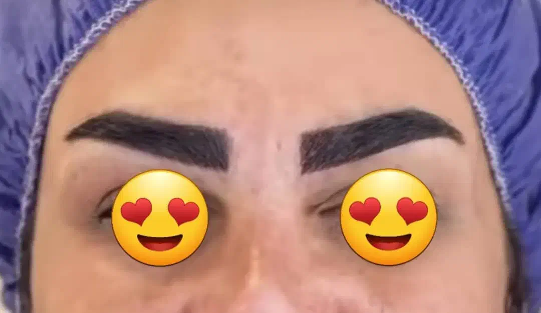 کاشت مو وابروتخصصی|خدمات آرایشگری و زیبایی|خرمشهر, |دیوار