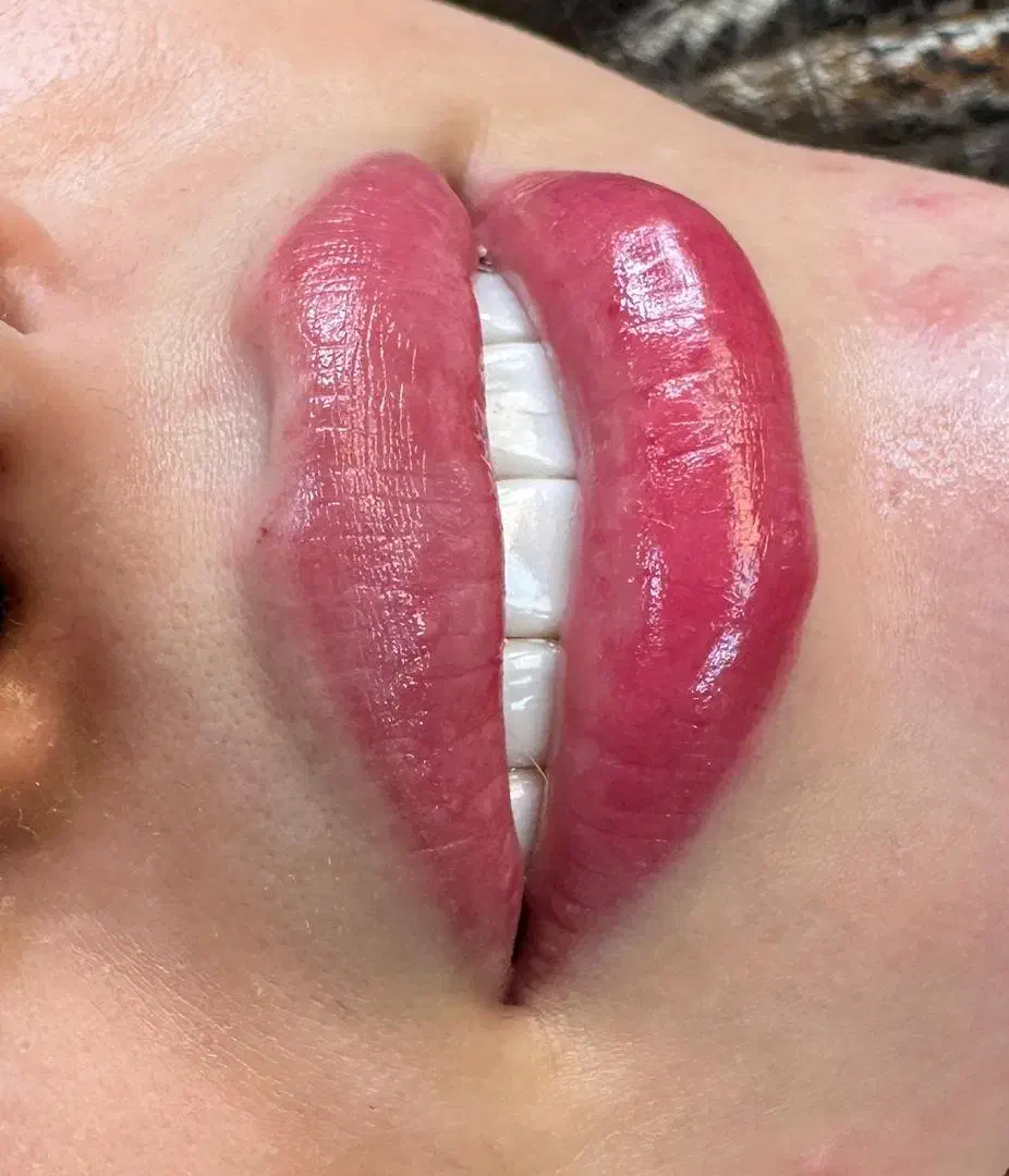 کلینیک لیزر  پوست و مو الیزا|خدمات آرایشگری و زیبایی|ری, اقدسیه|دیوار