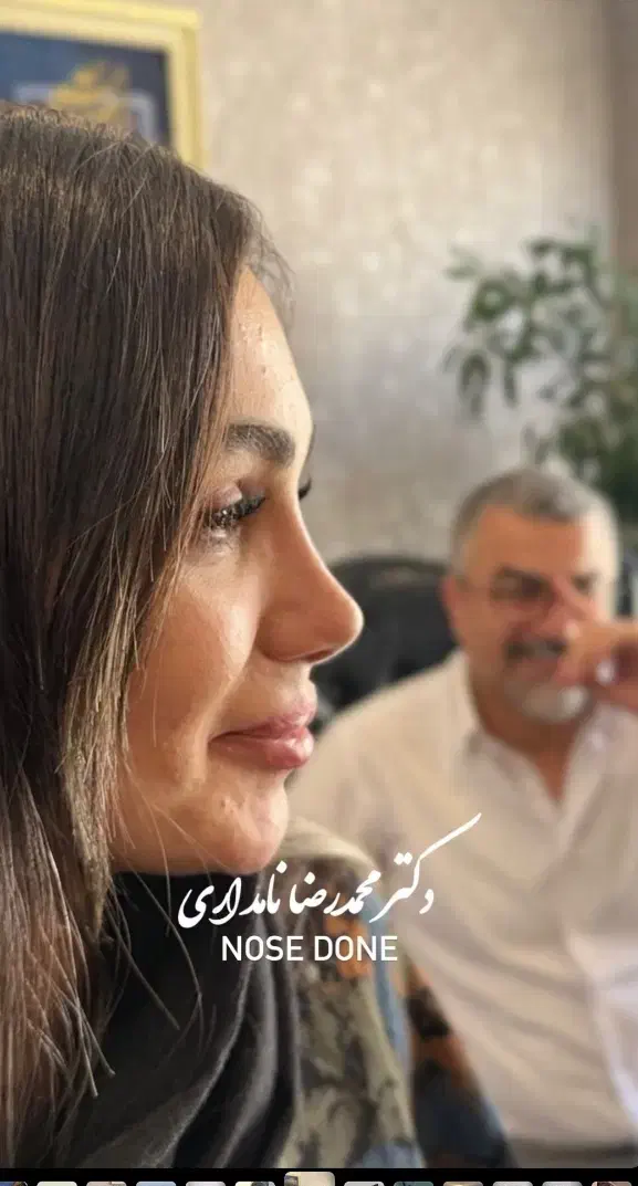 عمل بینی ( فقط ۳۱میلیون)|خدمات آرایشگری و زیبایی|بوئین و میاندشت, |دیوار