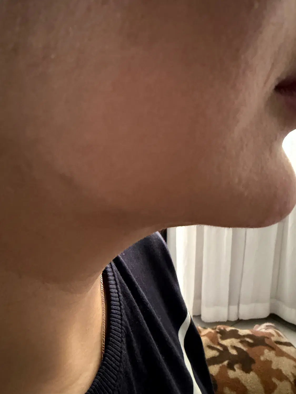 جشنواره ژل لب تزریق واموزش ژل بوتاکس چربی مزوتراپی|خدمات زیبایی و سلامت|تهران, شهران شمالی|دیوار