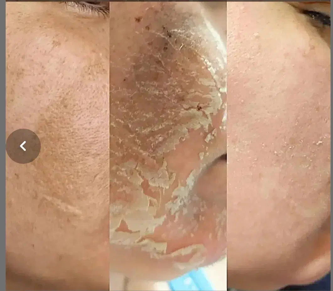 فیشیال و آلگاپیل و خالبرداری و هایفرکوئنسی|خدمات آرایشگری و زیبایی|شیراز, شریف‌آباد|دیوار