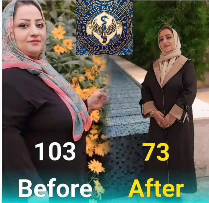 جشنواره لاغری و رسیدن به وزن ایده آل - دکتر بختیار|خدمات زیبایی و سلامت|اهواز, کوی ملی راه|دیوار