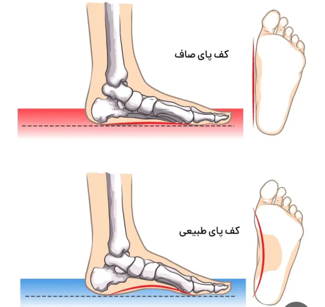 کلینیک تخصصی بهبود کف پای صاف|خدمات آرایشگری و زیبایی|رزن, |دیوار