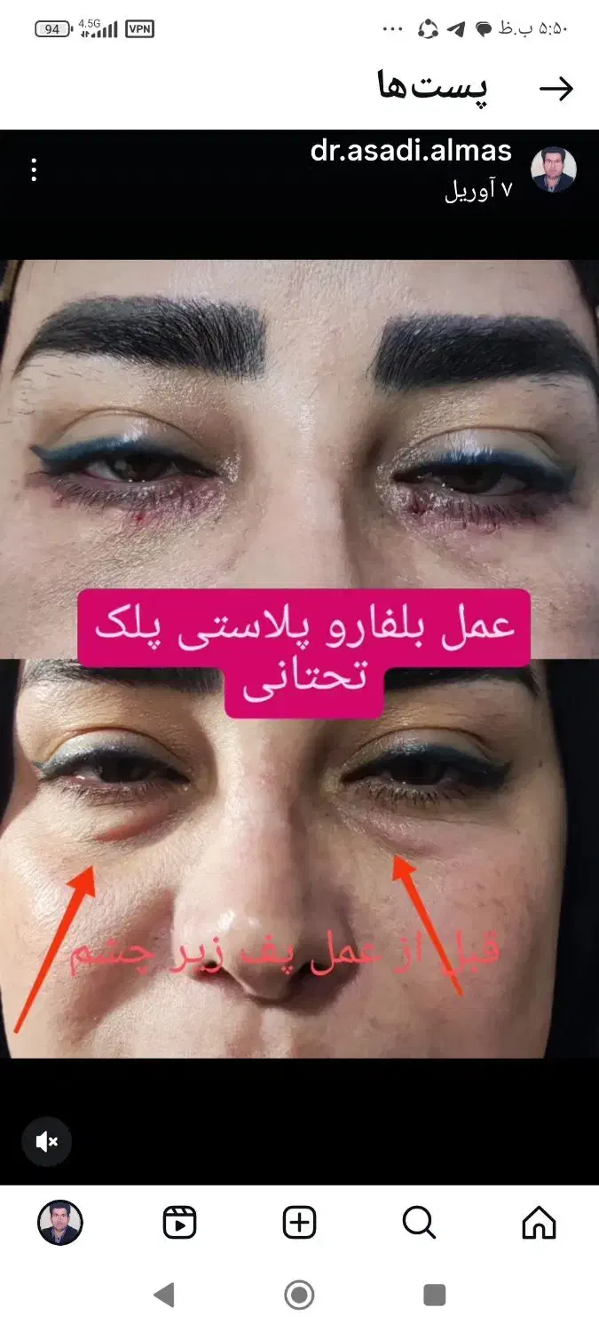 کلینک زیبایی وجراحی|خدمات آرایشگری و زیبایی|کنگاور, |دیوار