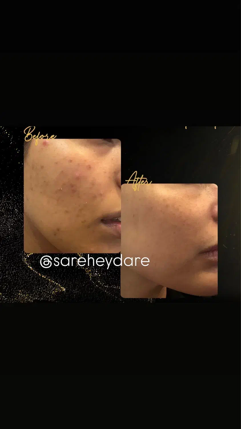 جشنواره هایفو و فیشیال|خدمات آرایشگری و زیبایی|کرج, حسن آباد|دیوار