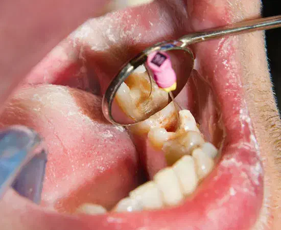 خدمات دندانپزشکی رایگان فرصت محدود زیر نظر متخصص|خدمات آرایشگری و زیبایی|تهران, فلسطین (میدان انقلاب)|دیوار