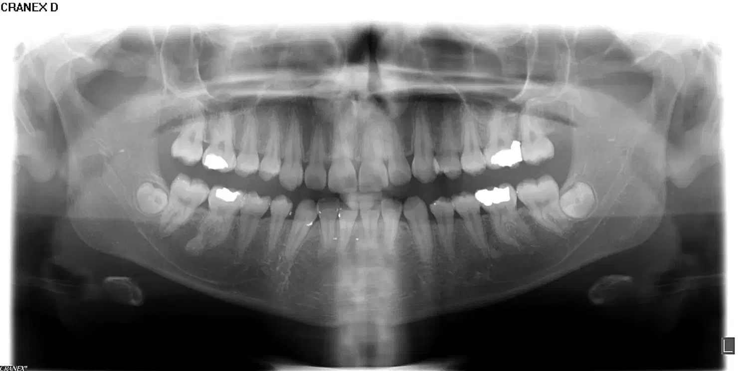 پذیرش ،مشاور ایمپلنت،دستیار تخصصی جراحی و ارتودنسی|استخدام درمانی، زیبایی، بهداشتی|فردیس, فردیس|دیوار