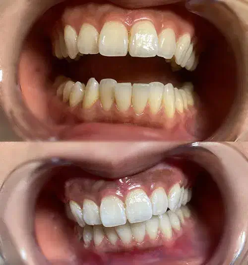 خدمات دندانپزشکی با شرایط ویژه|خدمات آرایشگری و زیبایی|زنجان, |دیوار