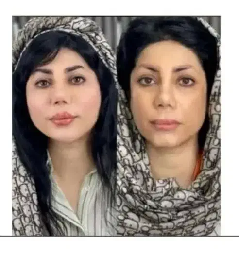 مرکز تخصصی جوانسازی اندولیفت/هایفو/لیفت فقط۸۹۰ت|خدمات آرایشگری و زیبایی|اصفهان, لاله|دیوار