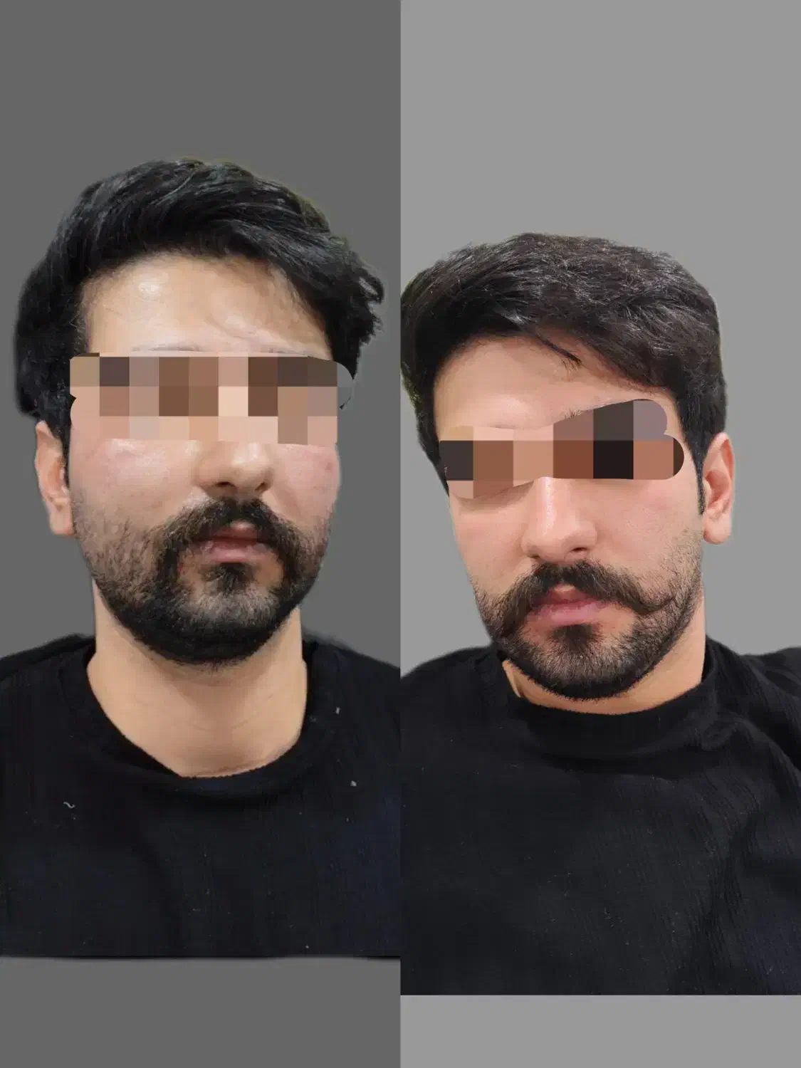 زیبا سازی|خدمات آرایشگری و زیبایی|سقز, |دیوار