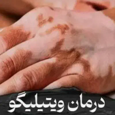 کاموفلاژ دائم|خدمات آرایشگری و زیبایی|تهران, بوستان چیتگر|دیوار