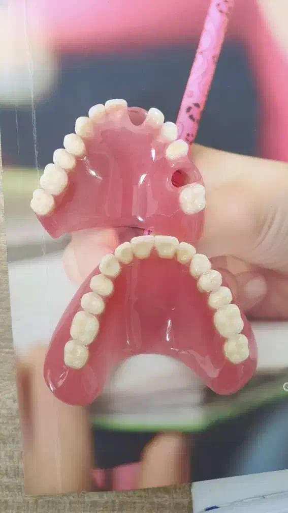 دندانسازی سپیددنتال|آرایشی، بهداشتی، درمانی|خرم‌آباد, |دیوار