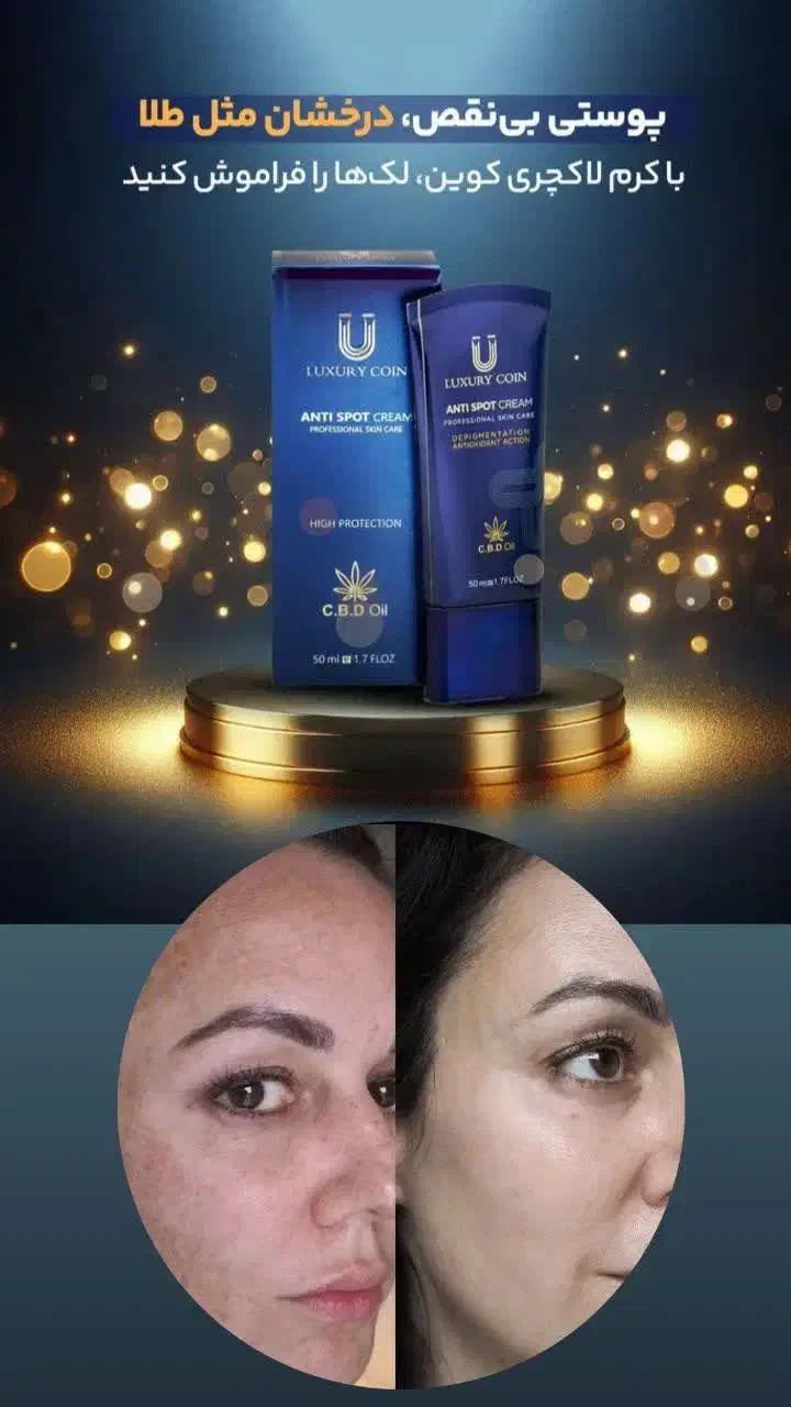 با کرم ضد لک لاکچری کوین دیگه لک نداشته باش|آرایشی، بهداشتی، درمانی|خواف, |دیوار
