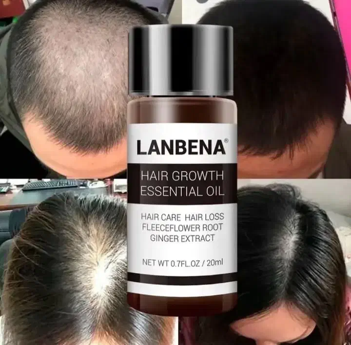 شامپو رزماری|آرایشی، بهداشتی، درمانی|برازجان, |دیوار