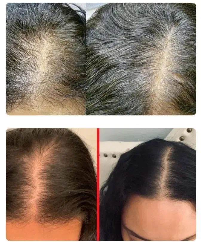 رشت آنی موی سر|خدمات آرایشگری و زیبایی|اهواز, کوی طلاب|دیوار