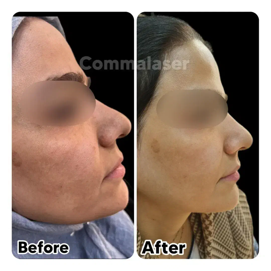 دستگاه هفت کاره فیشیال به همراه ماسک ال ای دی|آرایشی، بهداشتی، درمانی|پرند, فاز ۰|دیوار