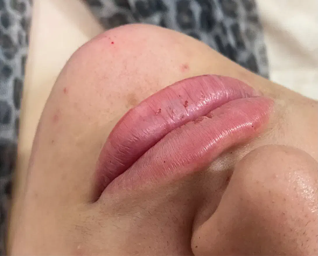 ژل. مزو ژل. جوانساز. بوتاکس|خدمات آرایشگری و زیبایی|کرج, حصارک پایین|دیوار