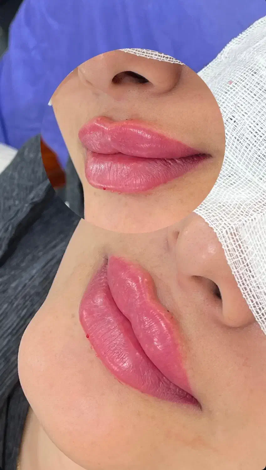 جشنواره تزریق فیلر،بوتاکس ،نخ،لاغری و هایفو|خدمات آرایشگری و زیبایی|تبریز, |دیوار