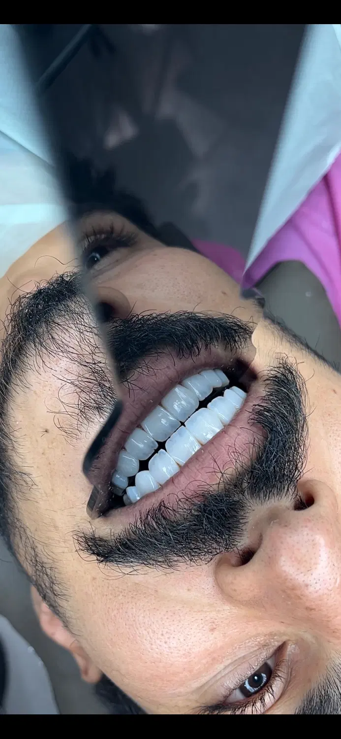 جشنواره ویژه ونیر کامپوزیت|خدمات زیبایی و سلامت|قم, زنبیل آباد|دیوار